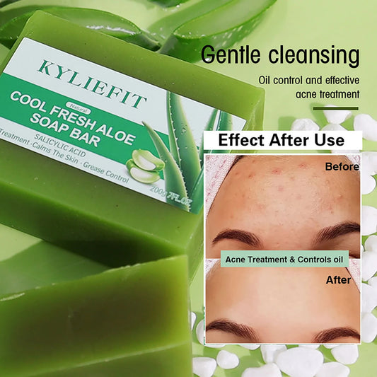 Aloe Vera Whitening Soap, Remove Acne, Spots, Skin Radiant, Improve Skin Luster, Vegan Bath Wash for All Skin Types, 200g